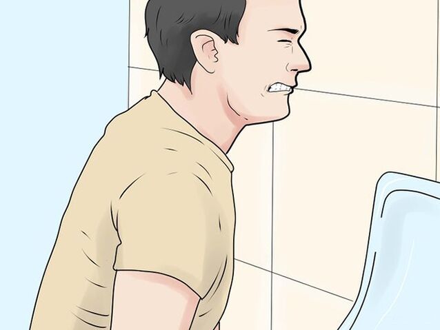 Painful urination is a symptom of worsening prostatitis in men