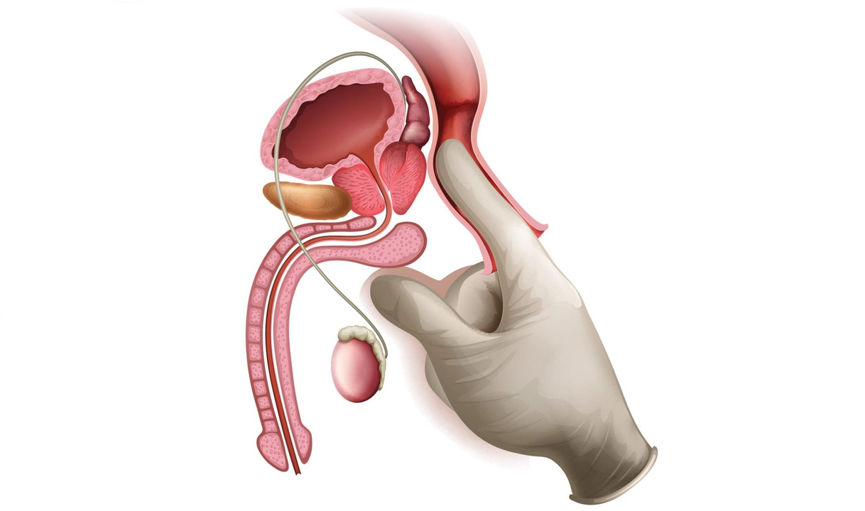 Prostate massage